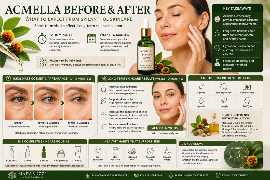 Educational infographic explaining Acmella oleracea before and after skincare results, showing the immediate 10–15 minute cosmetic appearance associated with spilanthol, long-term skincare benefits, factors affecting results, healthy skincare routines